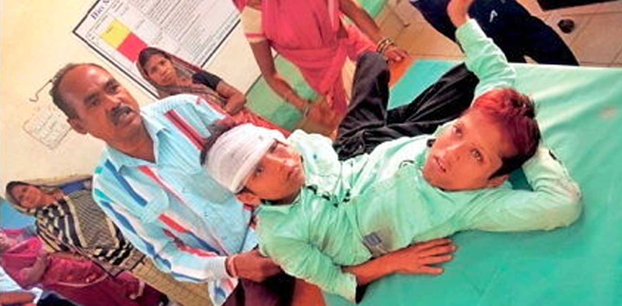 जुड़वां भाई शिवराम और शिवनाथ  दुर्घटना में घायल  होने के बाद ... - CG Sandesh