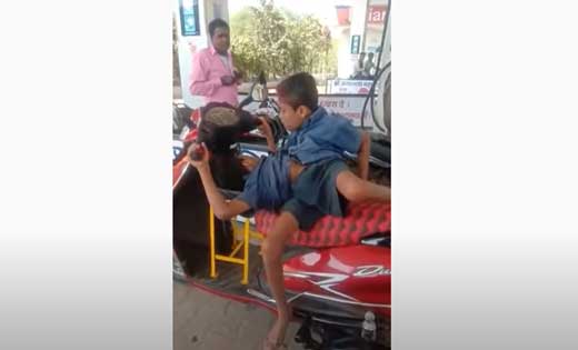 बलौदाबाजार : एक ही शरीर से जुड़े जुड़वा भाई शिवनाथ और शिवराम ... - CG Sandesh