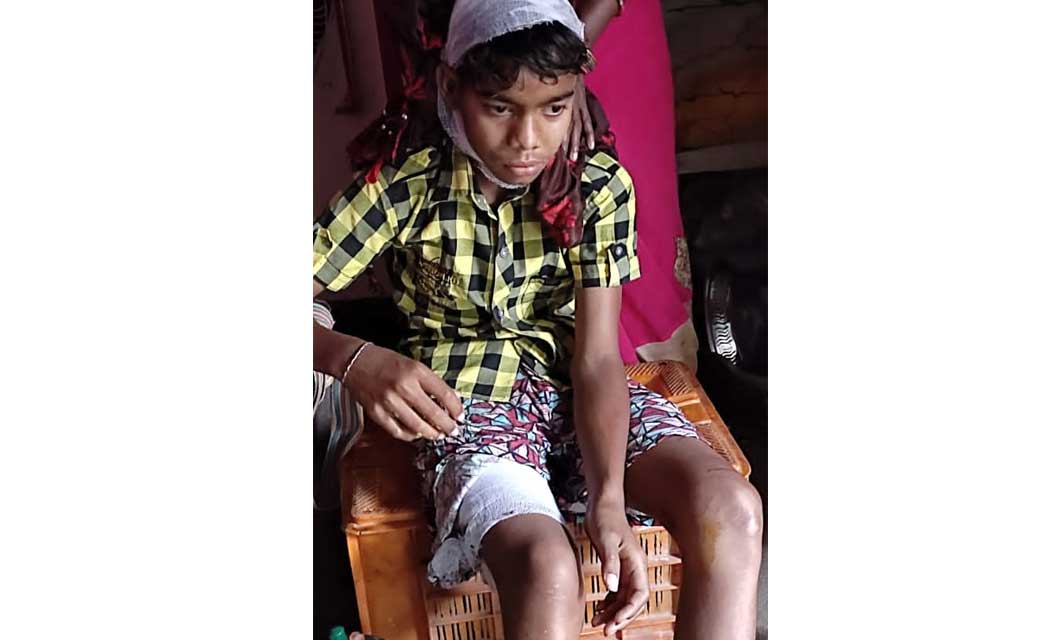 बागबाहरा : कोमाखान सुअरमार पहाड़ पर चार खाने गए बच्चों पर भालू ने किया हमला,  2 बच्चे हुए घायल
