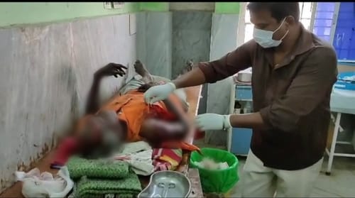 भालुओं ने किया युवक पर हमला, नोचा कंधा और उधेड़ दी सिर की चमड़... - CG Sandesh