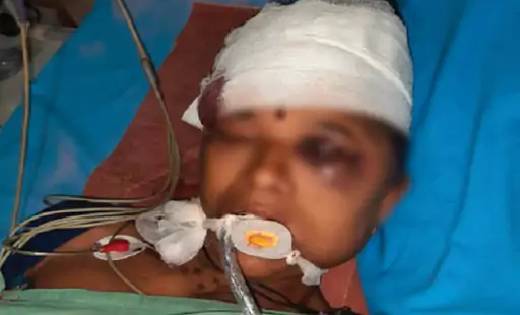 प्रेमी ने प्रेमिका की मां पर पत्थर पटककर मारा डाला , वजह जान... - CG Sandesh