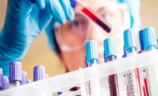 प्रदेश के वायरोलॉजी लैब के परिचालन के लिए तैयार हुई गाइडलाइन - CG Sandesh
