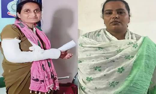 लेडी बदमाश ने महिला प्रहरी को जमकर पीटा ,हाथ में लगवाना पड़ा ... - CG Sandesh